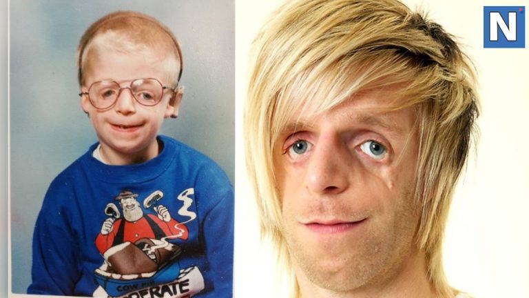 He Was Abandoned By His Parents For Being Ugly And Now He Is a HERO!