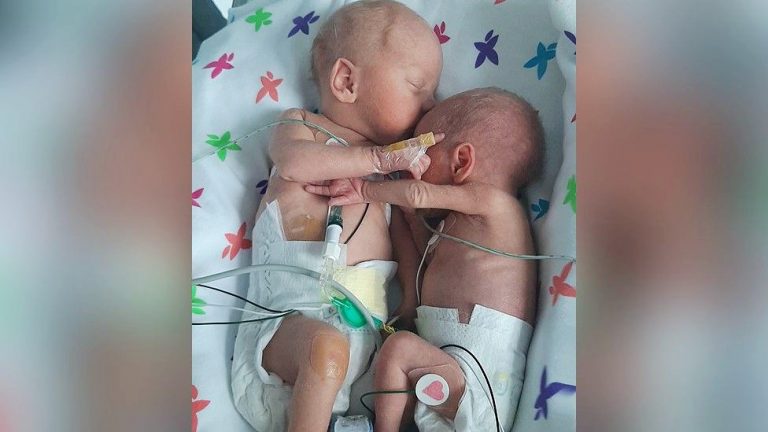 Premature twins separated at birth ‘cuddle and hold hands’