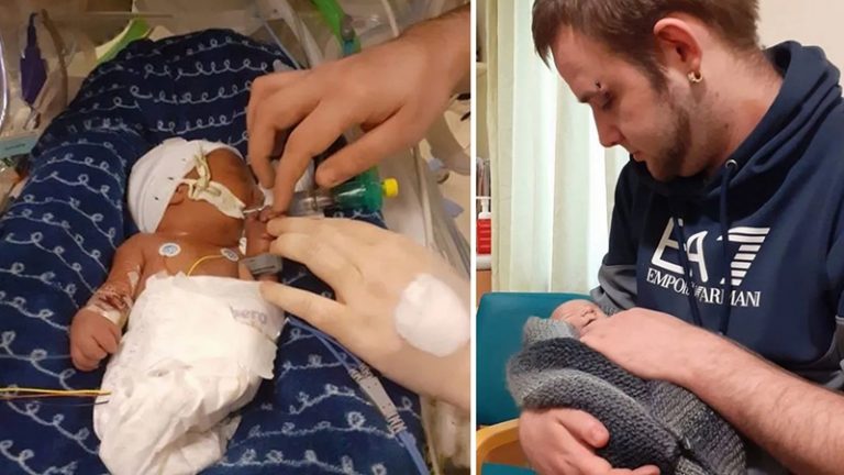 Baby Born With Legs Fused Lives 1 Day For Parents To Hold Him As He’s Baptized