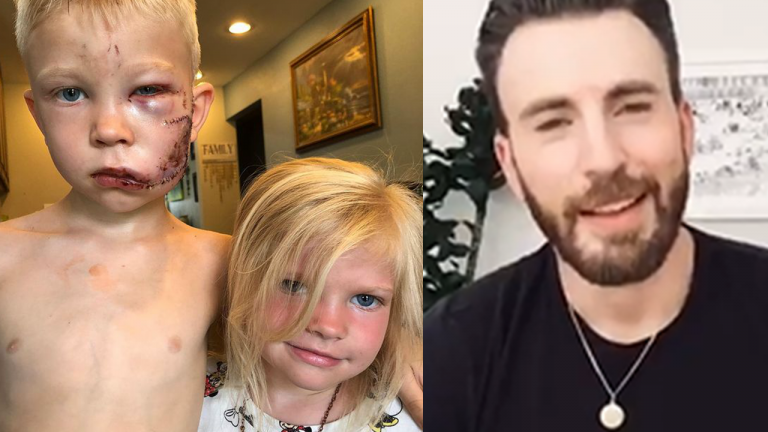 Marvel Actors Hail 6 Years Old As A Hero After He Risks His Life to Save Sister from Dog Attack