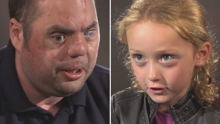 5-Year-Old Girl Meets Disfigured Veteran, Leaves Him Struggling To Hold Back Tears