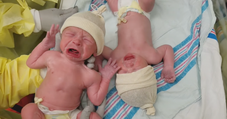 Nobody, Including The Doctors, Could Believe Their Eyes during These Twin Babies’ First Moments