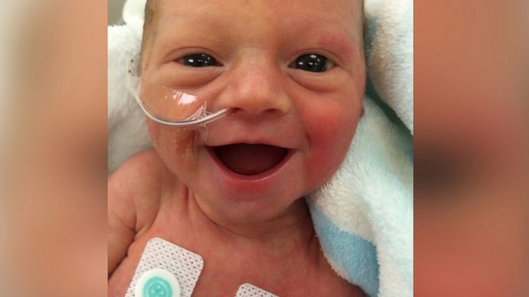 Premature Baby With Dazzling Smile Gives Hope to Parents