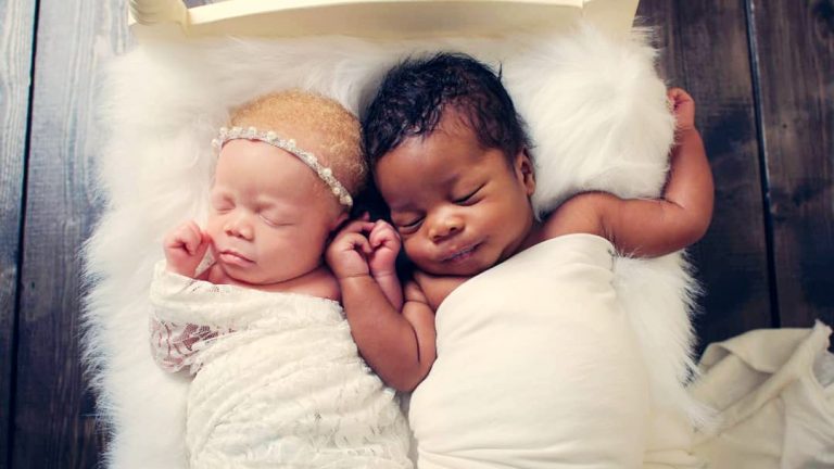 Photographer Gives Birth to Twins, One Black, the Other White, Takes Amazing Photos of Albino Daughter
