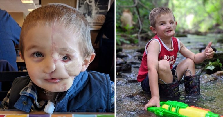 Boy, 5, Survives Savage Attack by Two Dogs Only to Be Called A ‘Monster’ in Public