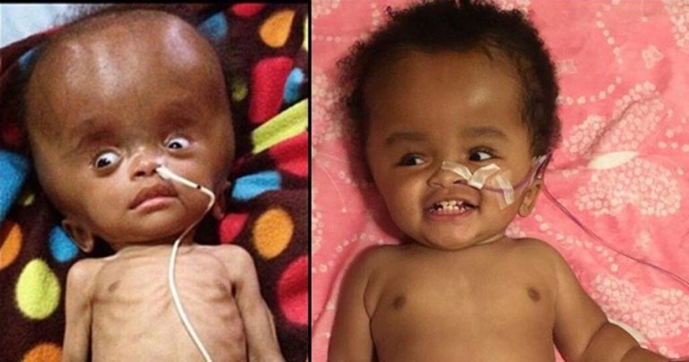 Doctors Said This Unwanted Baby Would Die, But God Sent A Miracle