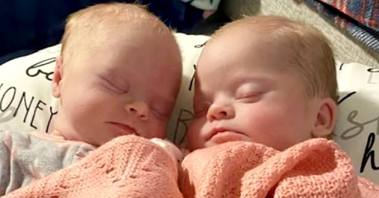 ‘My Little Gems’: Mom Gives Birth to Rare Set of Identical Twins with Down Syndrome