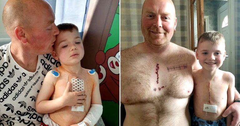 Father Gets Tattoo on Chest to Match Son’s life-Saving Heart Surgery Scar