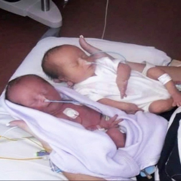 Couple expects identical twins — freeze when the doctor says ‘I’m sorry’